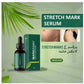 Markaway Stretch Mark Serum – Fast Skin Repair & Smooth Skin ✨