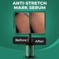 Markaway Stretch Mark Serum – Fast Skin Repair & Smooth Skin ✨